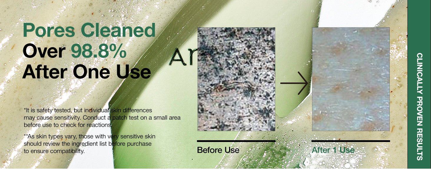 ANUA Heartleaf BHA Cleansing Foam 150ml – Korean Blackhead Remover, Pore Detox Face Wash