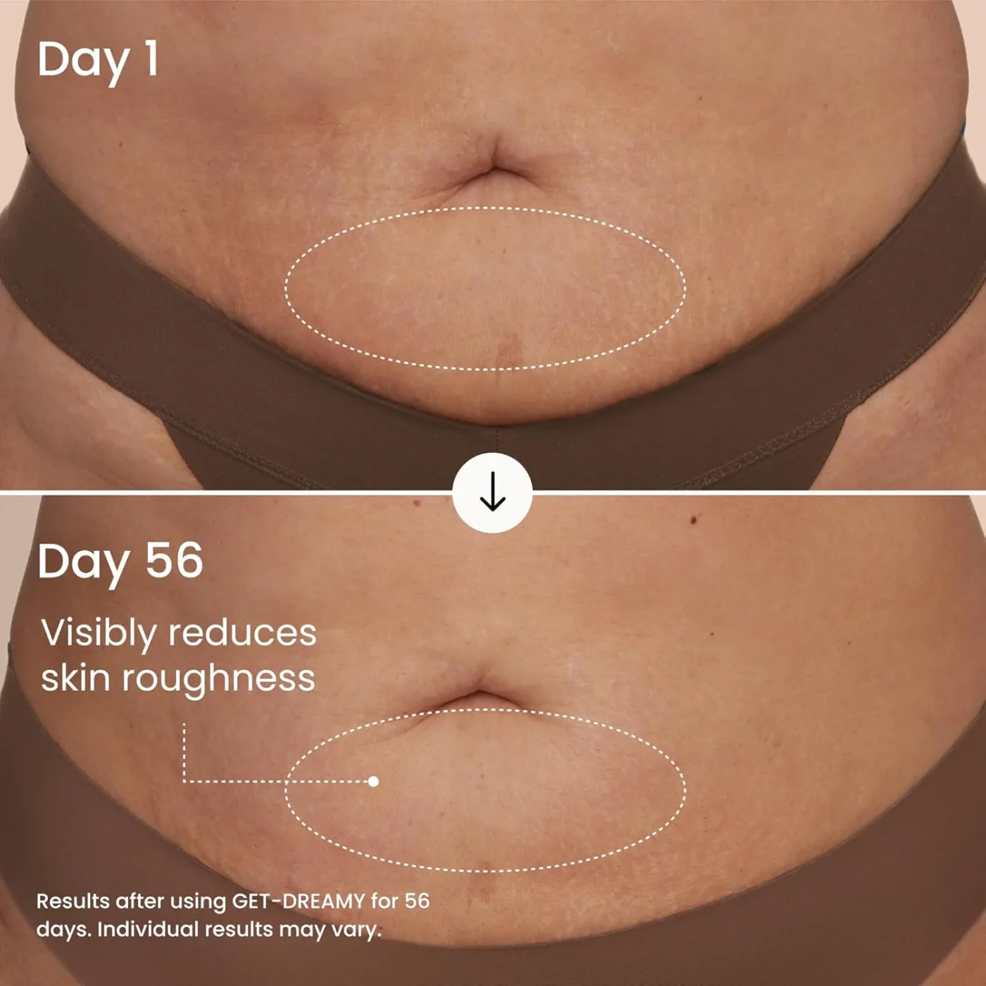 Overnight Cellulite Toning Cream