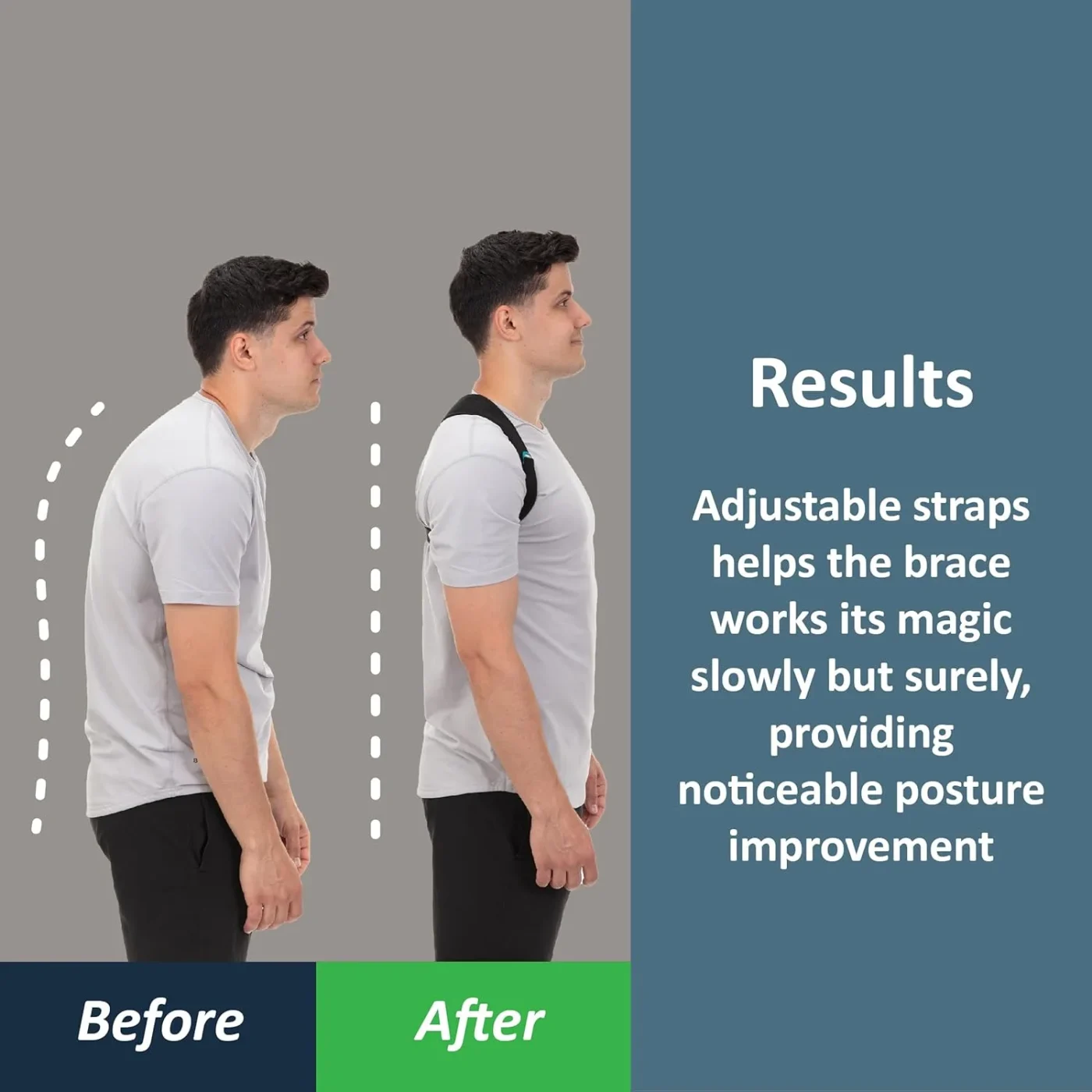 Posture Corrector Back Brace